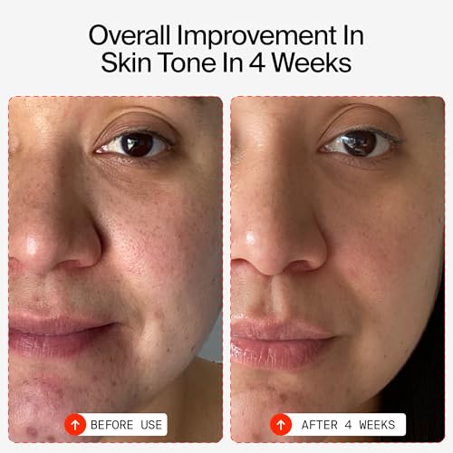 15% Vitamin C Face Serum V5079
